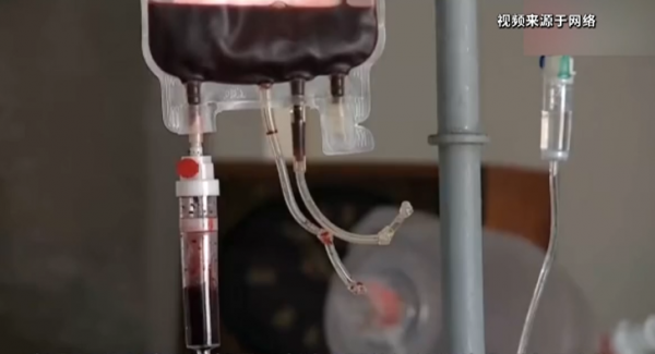 直系親屬之間能輸血嗎？醫生：這種情況下不建議