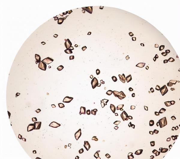 這種水果是“降酸王”，尿酸高的人群建議多吃