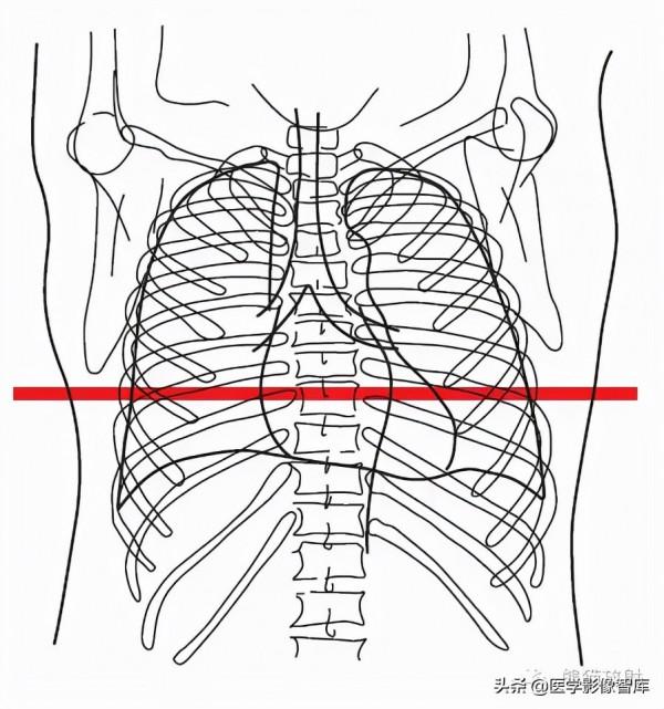 CT斷層解剖圖譜最全總結「推薦收藏」 CT斷層解剖圖譜最全總結「推薦收藏」