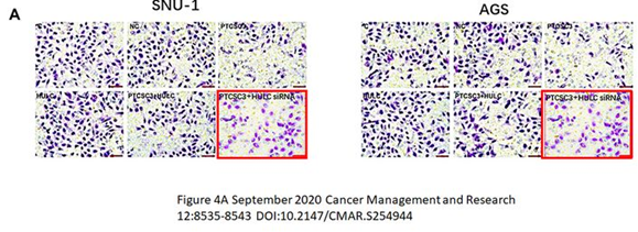 安徽醫科大學第一附屬醫院發表的SCI論文因圖片疑似重複被質疑