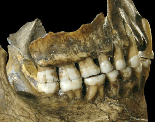 這些壯漢能練出異常發達的肌肉是否有尼安德特人遺傳的強壯基因？