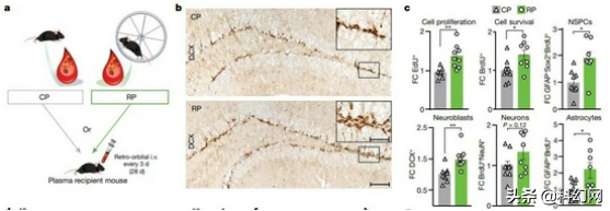 換上運動後“年輕血漿”或使年老小鼠大腦再生 換上運動後“年輕血漿”或使年老小鼠大腦再生