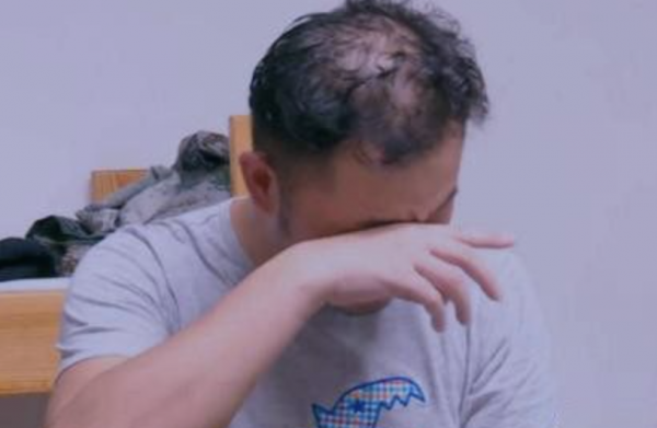 初見發如濃墨，再見禿頭禿腦！這12位男星的頭，讓女人好心碎