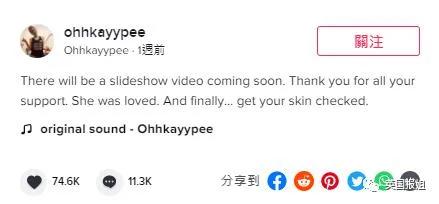 27歲網紅去世面板出狀況沒管三年後癌症晚期？