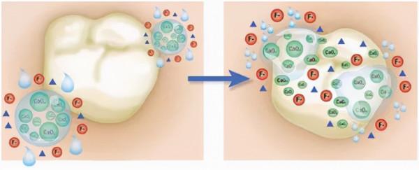 面對孩子的蛀牙，您考慮過&OpenCurlyDoubleQuote;塗氟&rdquo;嗎？