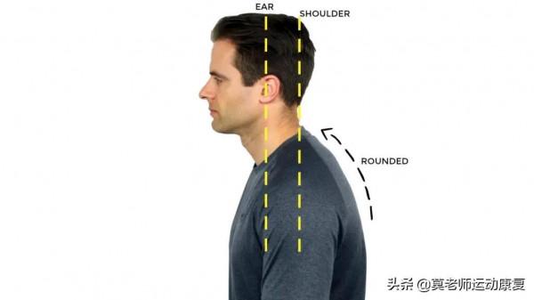 這3個動作幫你改善圓肩、駝背、頭前探