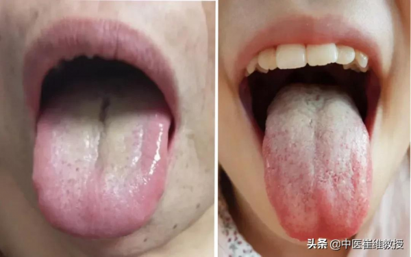 說說冬天進補的思路：吃點啥，怎麼補，才能達到真正的補益效果