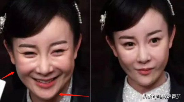 8位女星的整容“塌房路”：有人葬送事業，有人毀容，張檬可惜了