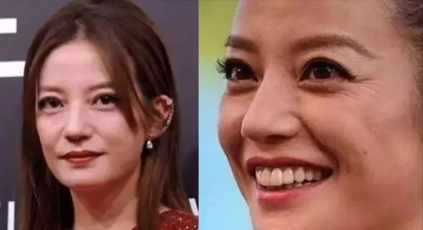 6位女星步入不惑之年,面容垮掉,膠原蛋白流失,彷彿整容失敗 6位女星步入不惑之年,面容垮掉,膠原蛋白流失,彷彿整容失敗