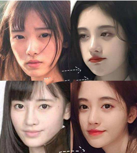 內娛“假鼻子”大PK，誰的假到逆天，誰的越整越殘？