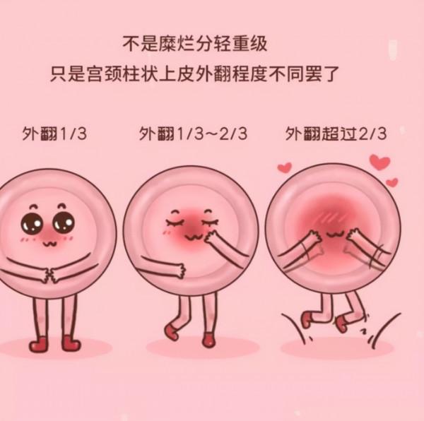 體檢時查出這4種病，醫生表示：或無需過度治療，不要自己嚇自己