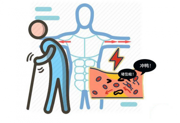 心血管病搶救要及時！記住發病的6個訊號，別給血栓機會