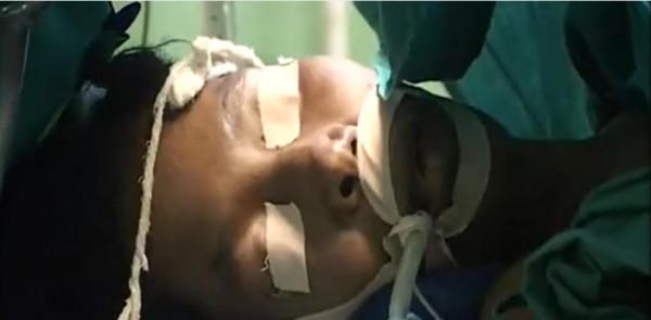 非洲醫院做手術，醫生就到點直接下班了