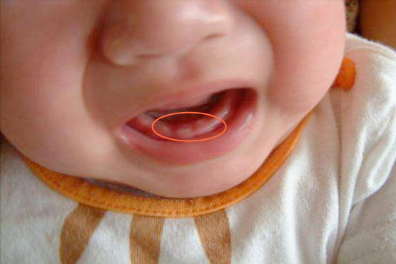 關於寶寶長牙你還有多少誤區?護理不當孩子遭罪,家長別不以為意 關於寶寶長牙你還有多少誤區?護理不當孩子遭罪,家長別不以為意