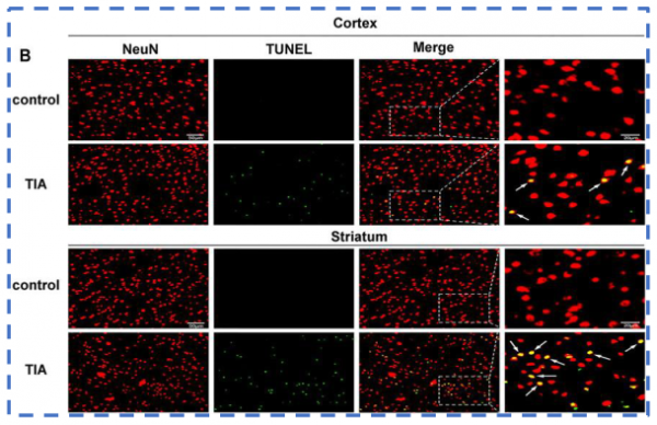 《Frontiers in Pharmacology》:丁苯酞促進TIA模型小鼠血管新生 《Frontiers in Pharmacology》:丁苯酞促進TIA模型小鼠血管新生