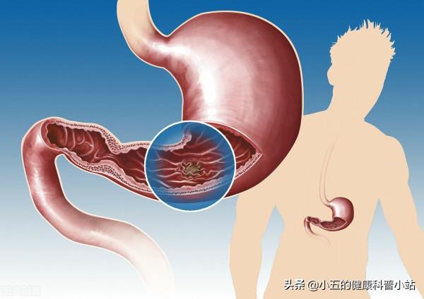 便宜的維生素B12是營養神經、改善貧血的良藥，服用時應注意5點