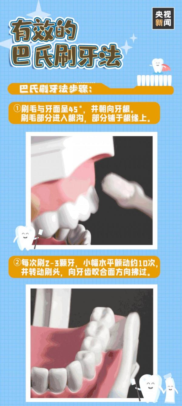 全國愛牙日｜蟲牙、智齒？全國愛牙日，健康從“齒”開始