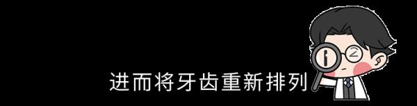 為什麼只要戴牙套,牙齒就可以恢復得很整齊?生動展示矯正過程 為什麼只要戴牙套,牙齒就可以恢復得很整齊?生動展示矯正過程