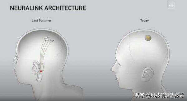 腦機介面+自動駕駛，未來駕駛新場景？