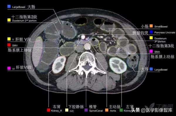 CT斷層解剖圖譜最全總結「推薦收藏」 CT斷層解剖圖譜最全總結「推薦收藏」