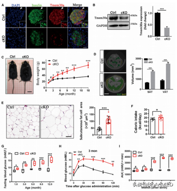 Molecular Therapy | 朱獻軍等揭示Tmem30a調控胰島素分泌的機制等 Molecular Therapy | 朱獻軍等揭示Tmem30a調控胰島素分泌的機制等