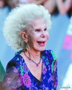 阿爾貝女公爵：整容整成猴，小24歲公務員對她一見鍾情，85歲再婚
