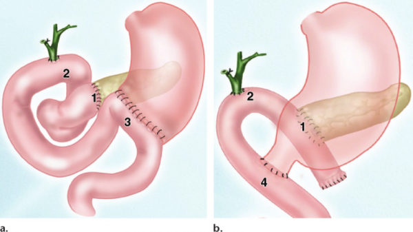 女子月經不調就醫38天后死亡，死亡原因到底是什麼？