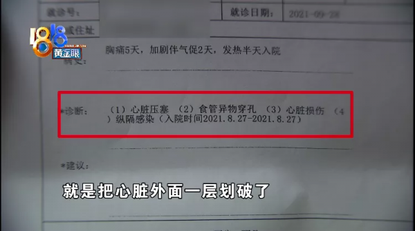 金屬絲劃破孩子心臟，家長推測“鋼絲刷”