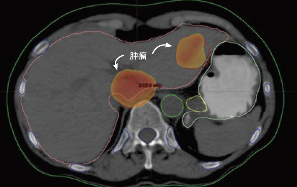 “永生”的拉克斯：身患絕症卻成研究物件，被科學界無償利用70年