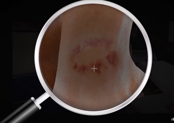 23歲男子為早點繼承遺產，燒死億萬身家的父母，腳踝傷疤將其暴露