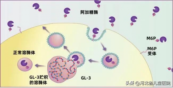 手腳疼痛、無法出汗的“怪病”? 手腳疼痛、無法出汗的“怪病”?