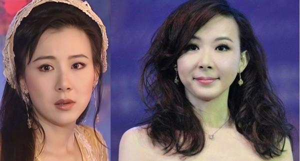 越整越難看後遺症一堆的9位女星！臉像鞋拔子，不敢做大表情