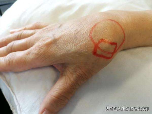 50歲左右的中老年人，手指僵硬、疼痛、怕冷、變形，預示哪些疾病