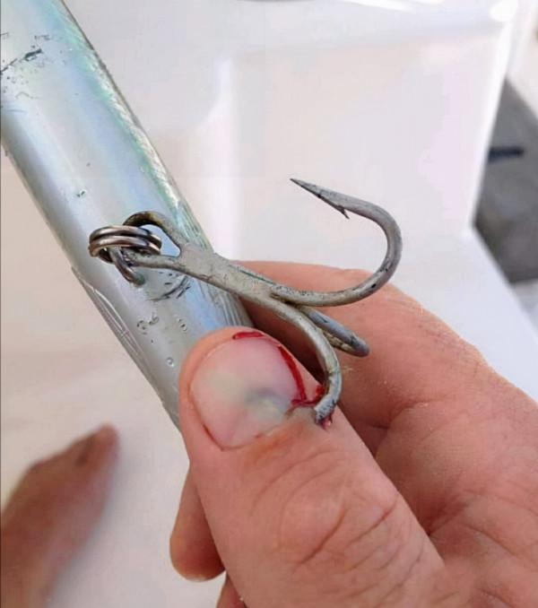 盤點釣魚人各種花式釣自己，看著就很疼！預防和處理方法分享