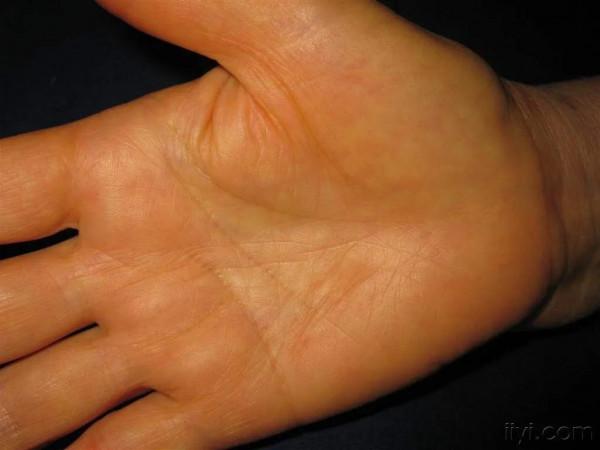 【手掌持續發黃，不痛不癢，是內臟受損？怎麼應對呢？】