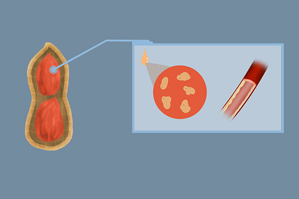 食用油有優劣之分？醫生闢謠：沒有最好的食用油，只有最差的吃法