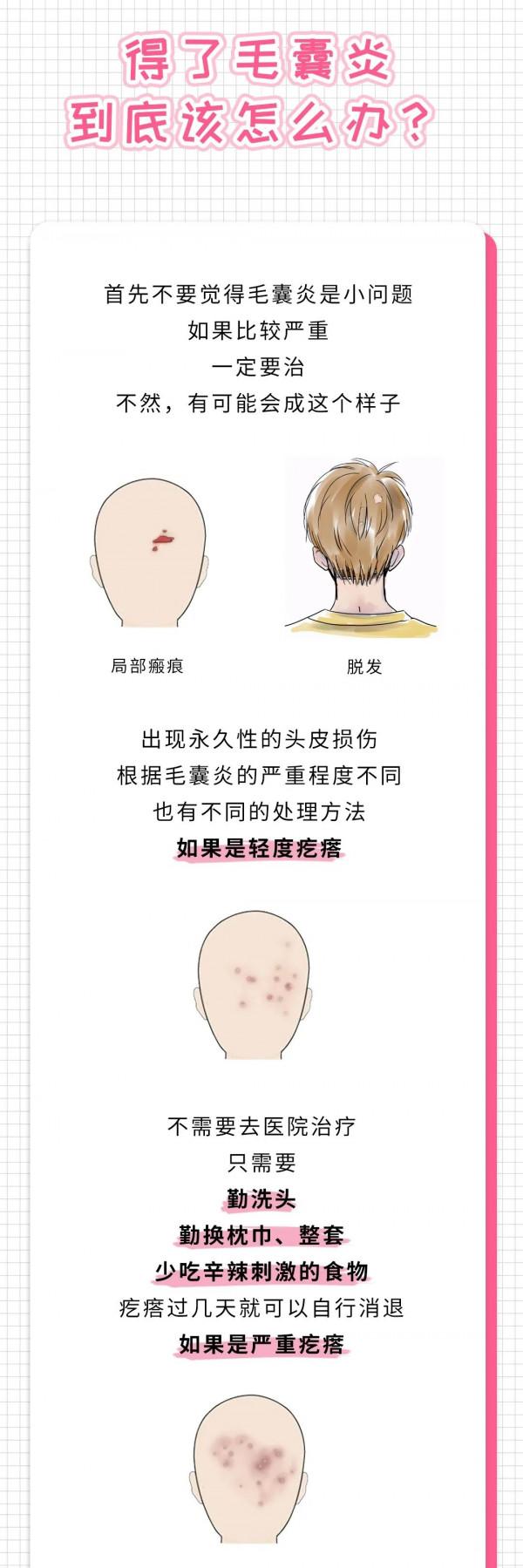 「健康科普」頭皮上為什麼會長小紅疙瘩？