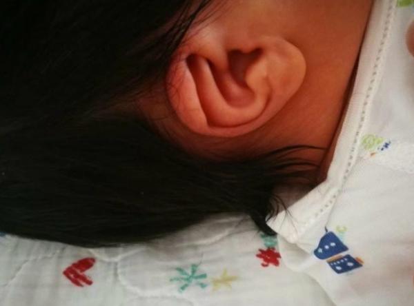 孩子耳朵裡進了異物怎麼辦?別慌!儘早就醫 孩子耳朵裡進了異物怎麼辦?別慌!儘早就醫