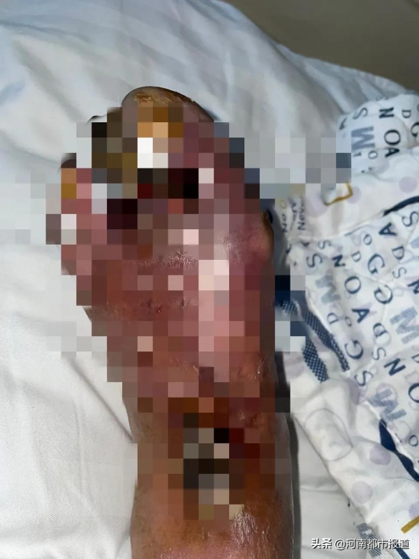 太可怕了！你還能認出這是腳嗎？