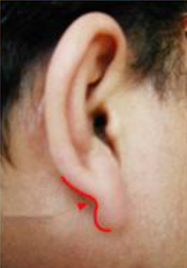 耳朵是身體的“長壽開關”每天揉一揉趕走小毛病