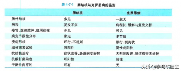 男子腹痛,以為闌尾炎,直到出現口腔潰瘍才發現闌尾切錯了 男子腹痛,以為闌尾炎,直到出現口腔潰瘍才發現闌尾切錯了