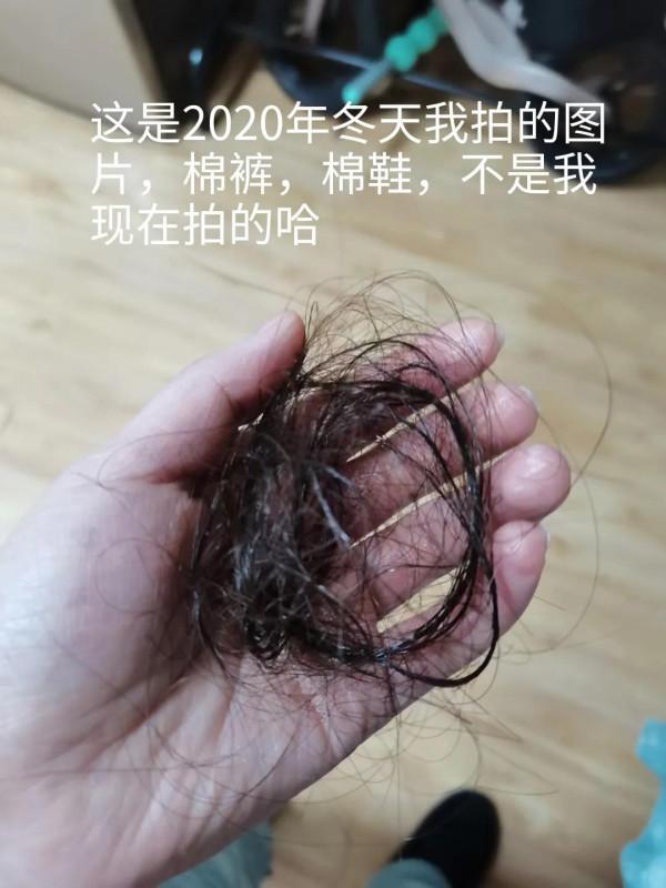 關於茶枯洗頭治脫髮的一些事 關於茶枯洗頭治脫髮的一些事