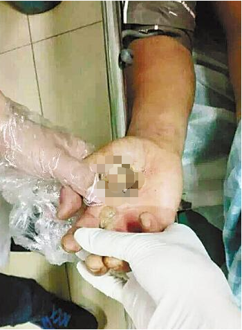 印尼一保安雨中行走遭雷劈，告誡釣友作釣一定要遠離極端天氣