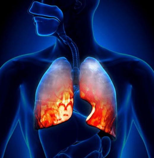 長期吸菸的人，突然把煙戒了，是好事還是壞事呢？建議瞭解一下