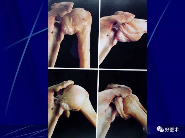 86張全身關節應用解剖精講，這篇文章值得收藏