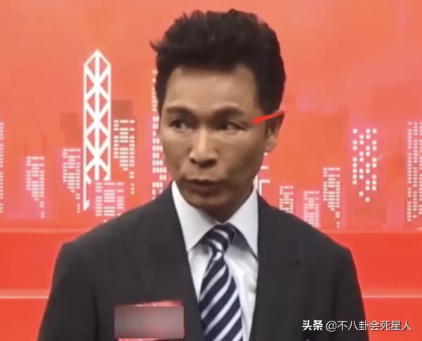 僵硬浮腫，像男芭比，中年男星動臉簡直是“災難現場”