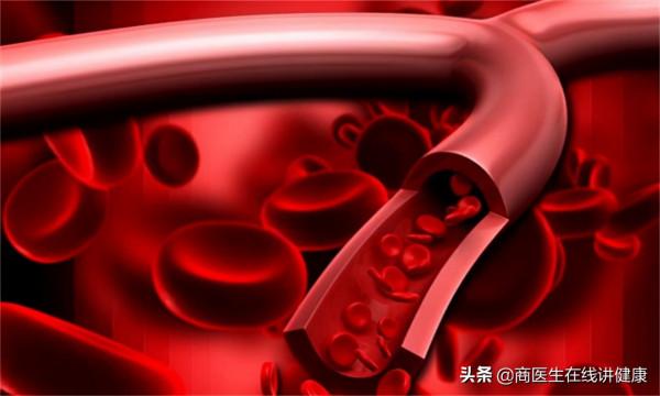 糖尿病病人應該是多喝水還是少喝水？