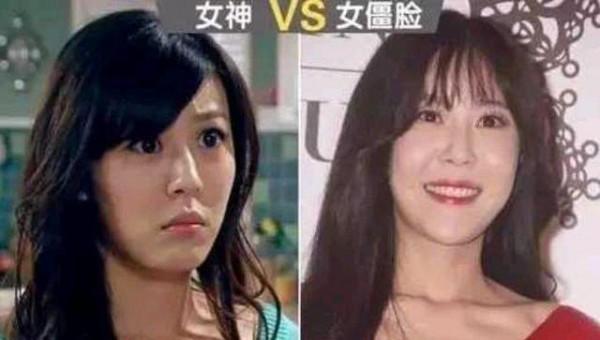 10位女星打玻尿酸前後，楊蓉、戚薇上榜，你還敢盲目“變美”嗎？