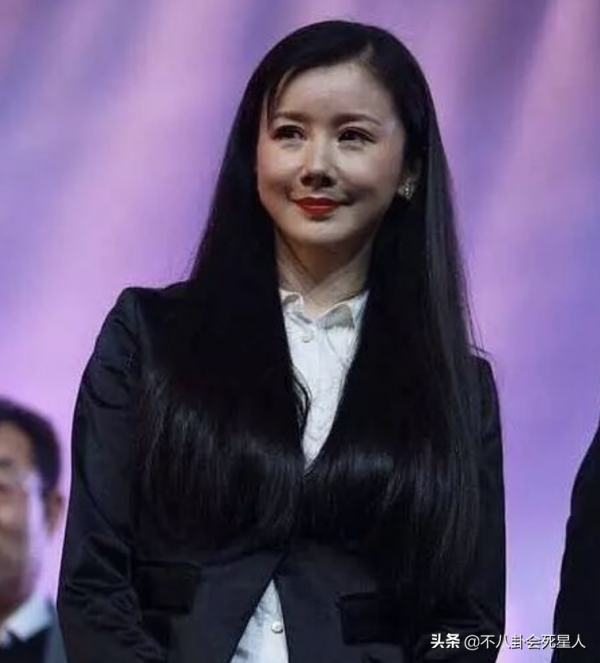 中年女星整容後遺症一堆！臉像鞋拔子，不敢做大表情，演戲沒法看