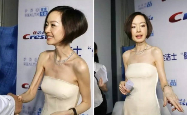 臉部凹陷如鬼，脖子青筋暴起，這些暴瘦的女星自己不害怕嗎？